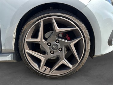 Ford fiesta st 1.5 ecoboost 200ch pack gris fox occasion toulouse (31) simplicicar simplicibike france